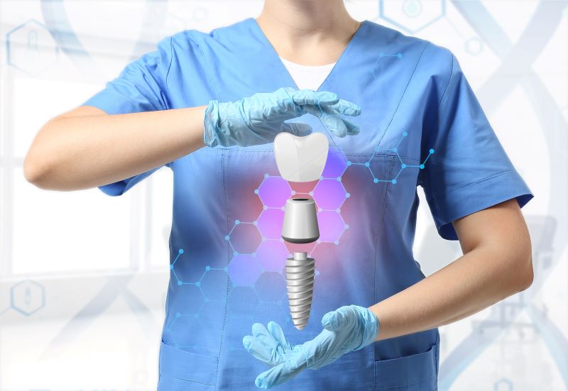 5 Amazing Benefits Of Titanium Dental Implants